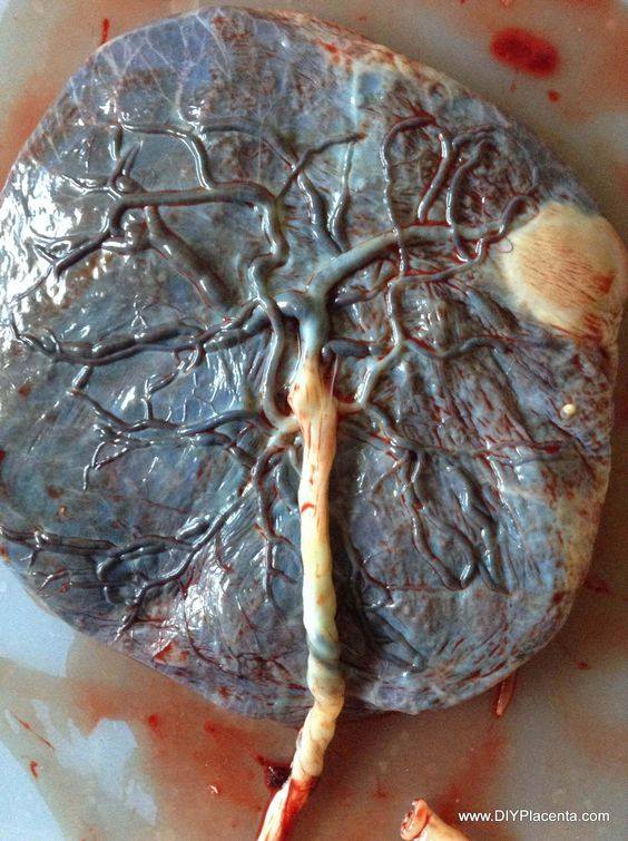 Placenta found only in female bodies - pregnancy and after birth